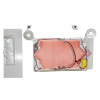 Exit combo assembly